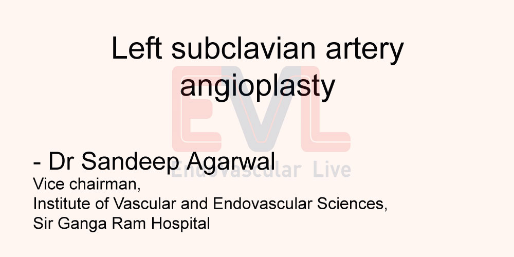 Left subclavian artery angioplasty